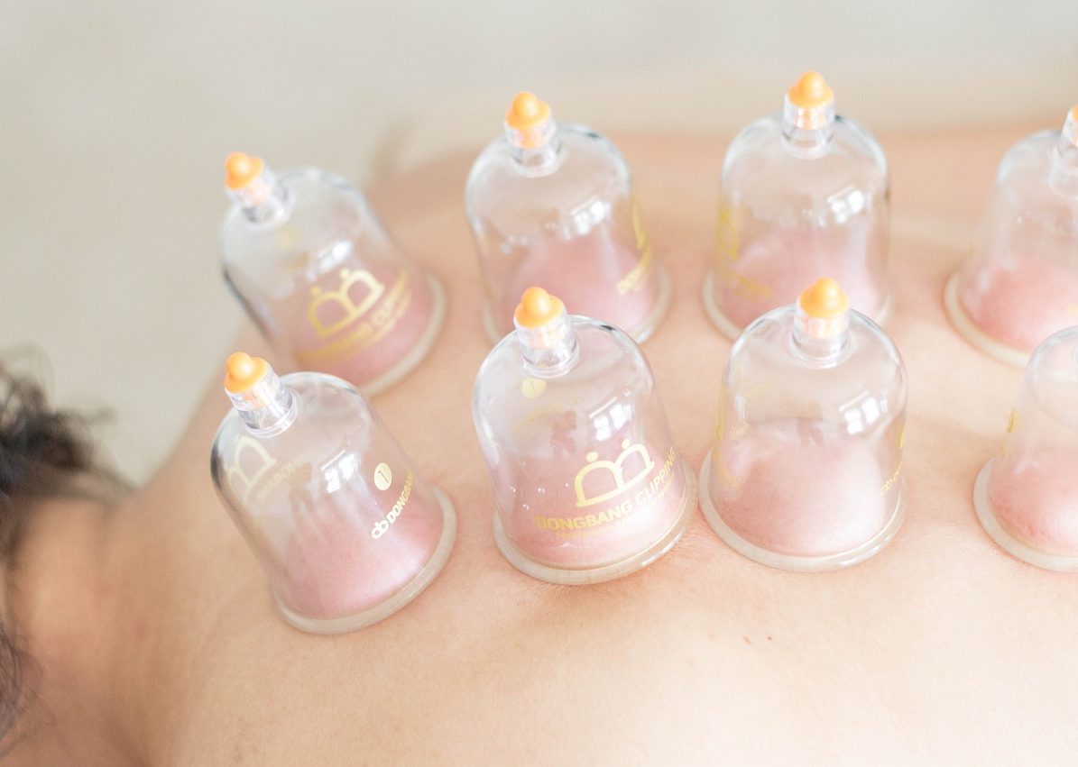 Schröpfen
Heilpraktikerin
Mareike Janßen-Gotowka in Bockhorn 
